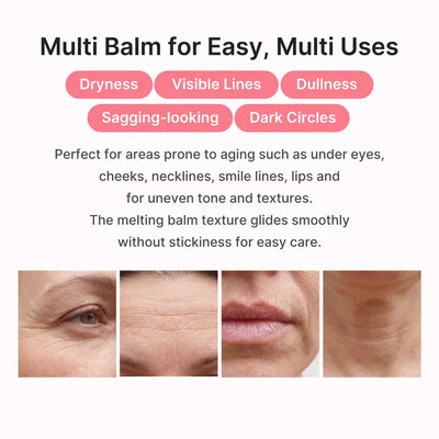 Plump Back Volume In Your Under Eyes, Lips & Smile Lines